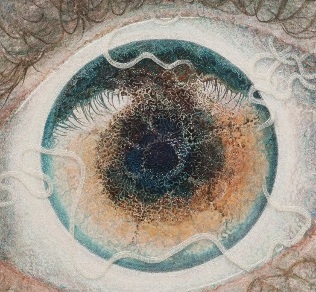 eye parasites