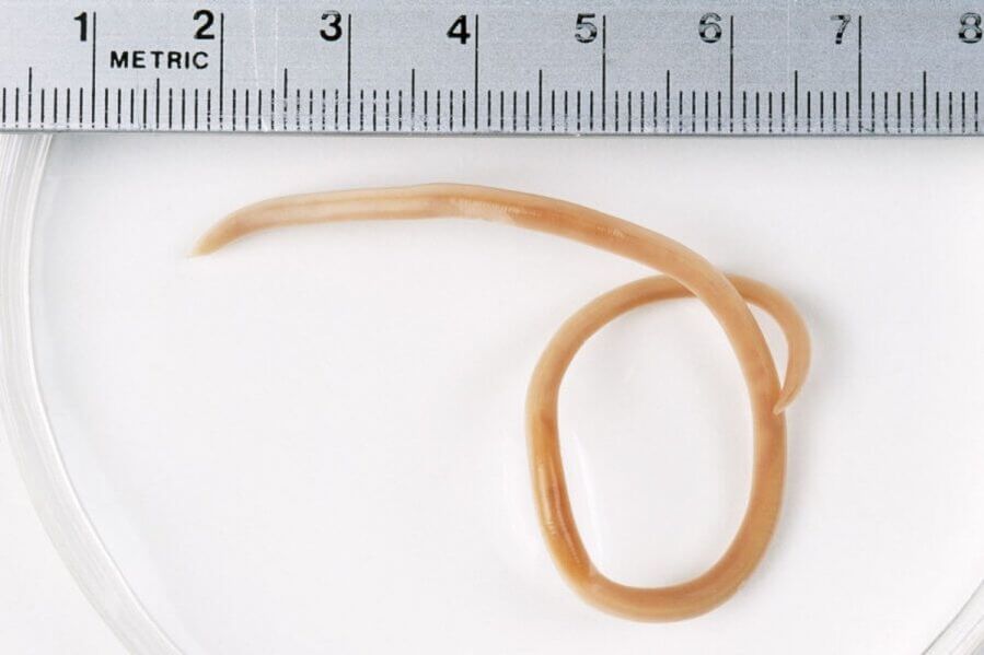 Ascaris is a roundworm that lives in the human body. 